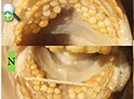 مراحل جنینی و لاروی سیم دندان‌نمای هندی
